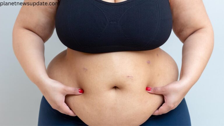 Natural Remedies for Belly Fat