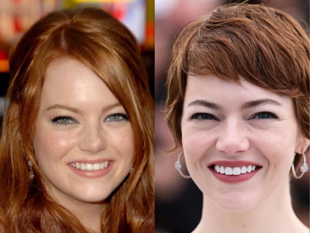 Emma Stone has been spotted wearing Invisalign