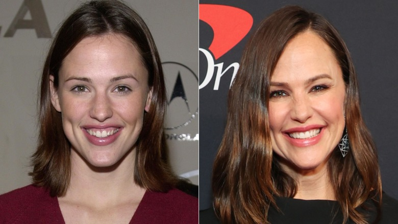 Jennifer Garner used Invisalign