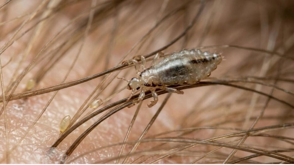 Lice
